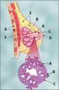 Invasive ductal Carcinoma